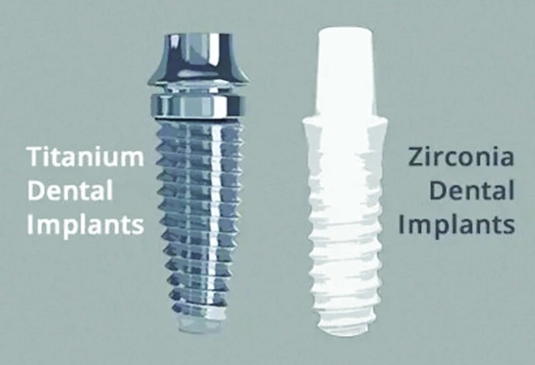 Side-by-side comparison of titanium and zirconia dental implants showing their distinct colors and textures.